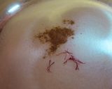 A picture of step 2 of Gulab jamun.