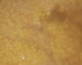 A picture of step 3 of Fry daal.