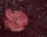 A picture of step 1 of Cherry pie filling.