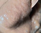 Foto del paso 1 de la receta: Sopaipillas ultra esponjosas sin gluten