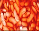 A picture of step 1 of Rajma curry.