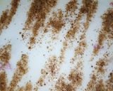 A picture of step 13 of Vegetable Chickpea Dahi Bara.