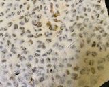A picture of step 7 of Moong dal parantha.
