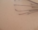 A picture of step 2 of Dahi Bare.