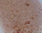 A picture of step 3 of Cinnamon bread roll.