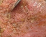 A picture of step 5 of Onion Capsicum Masala 📌.