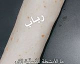 صورة لخطوة 5 من وصفة شاورما سريعة