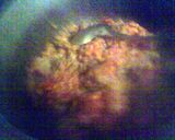 A picture of step 1 of CHILLI WITH BEANS®.