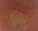 A picture of step 5 of Gobhi Mussalam.