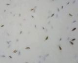 A picture of step 2 of Khati meethi aloo samosa chat.