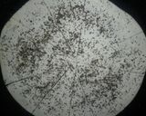 Foto del paso 2 de la receta: Minis medialunas