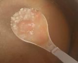 A picture of step 2 of Mash ki Daal.