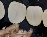 भंडारे वाली अचारी आलू (bhandare wali achari aloo recipe in Hindi) रेसिपी चरण 1 फोटो