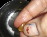 A picture of step 4 of Jaggery cough remedy goli.