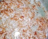 A picture of step 1 of Mutton Biryani.