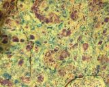 A picture of step 5 of Palak paratha.