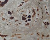 A picture of step 4 of Crispy paratha for sehri.