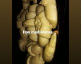 Foto del paso 4 de la receta: Medialunas dulces caseritas