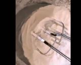 A picture of step 1 of Fruit Cream.