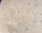 A picture of step 5 of Aloo ka paratha.