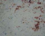 Foto del paso 2 de la receta: Quesadilla Charrúa.-   Panqueques Verdura Queso