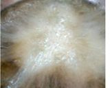 A picture of step 2 of Potato Muruku/Chaklis.