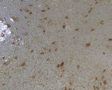 A picture of step 2 of Zeera Rice 🍚.