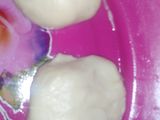 فطير بيتي
