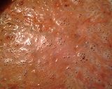 A picture of step 1 of Hotdogs with rice casserole II.