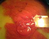 sweet and sour pork recipe step 6 photo