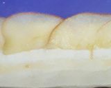A picture of step 12 of Apple Rose Pastries.