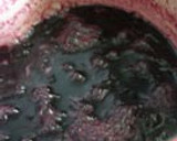 A picture of step 4 of Grape Jam.