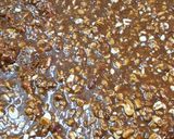 A picture of step 6 of Dry fruit chikki.