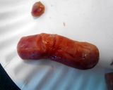 A picture of step 5 of Bloody Severed Fingers ( hot dogs with ketchup ) halloween.