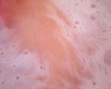 A picture of step 2 of Pineapple & watermelon juice #bestof2019.