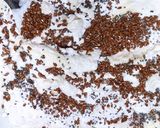 Foto del paso 1 de la receta: Masa de mayonesa para tartas (súper fácil)