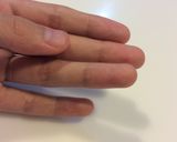 A picture of step 1 of TIP : Clean Hands with Butter.