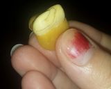 A picture of step 5 of Spicy Garlic Lupini Beans.