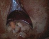 صورة لخطوة 2 من وصفة لو بيا ڨريني