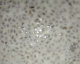 A picture of step 3 of Chia seeds smoothie.
