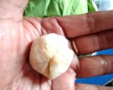 A picture of step 7 of Kachori.