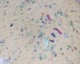 A picture of step 2 of Leftover Dal & salad paratha.