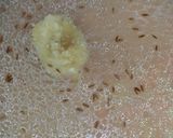 A picture of step 5 of Traditional Panchmel Daal 😋.