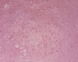 Foto del paso 5 de la receta: Gelatina espumosa. 🧁
