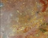 A picture of step 8 of Cabbage kofta.