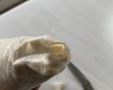 A picture of step 2 of Doughnut balls.