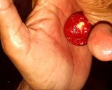 A picture of step 5 of Lotus sweet.