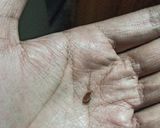 A picture of step 9 of Kala Chana.