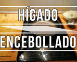 Foto del paso 1 de la receta: Hígado encebollado