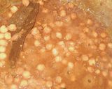 A picture of step 5 of Luchi Chole (Luchi Chole Recipe).